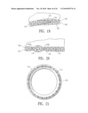 ENDOVASCULAR GRAFT JOINT AND METHOD FOR MANUFACTURE diagram and image