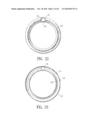 ENDOVASCULAR GRAFT JOINT AND METHOD FOR MANUFACTURE diagram and image