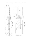 ENDOVASCULAR GRAFT JOINT AND METHOD FOR MANUFACTURE diagram and image