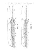 ENDOVASCULAR GRAFT JOINT AND METHOD FOR MANUFACTURE diagram and image