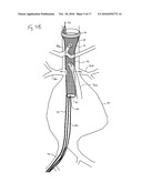 ENDOVASCULAR ROUTER DEVICE AND METHOD diagram and image