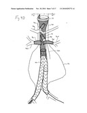 ENDOVASCULAR ROUTER DEVICE AND METHOD diagram and image