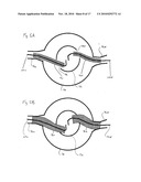 ENDOVASCULAR ROUTER DEVICE AND METHOD diagram and image