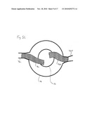 ENDOVASCULAR ROUTER DEVICE AND METHOD diagram and image