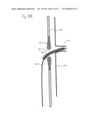 ENDOVASCULAR ROUTER DEVICE AND METHOD diagram and image