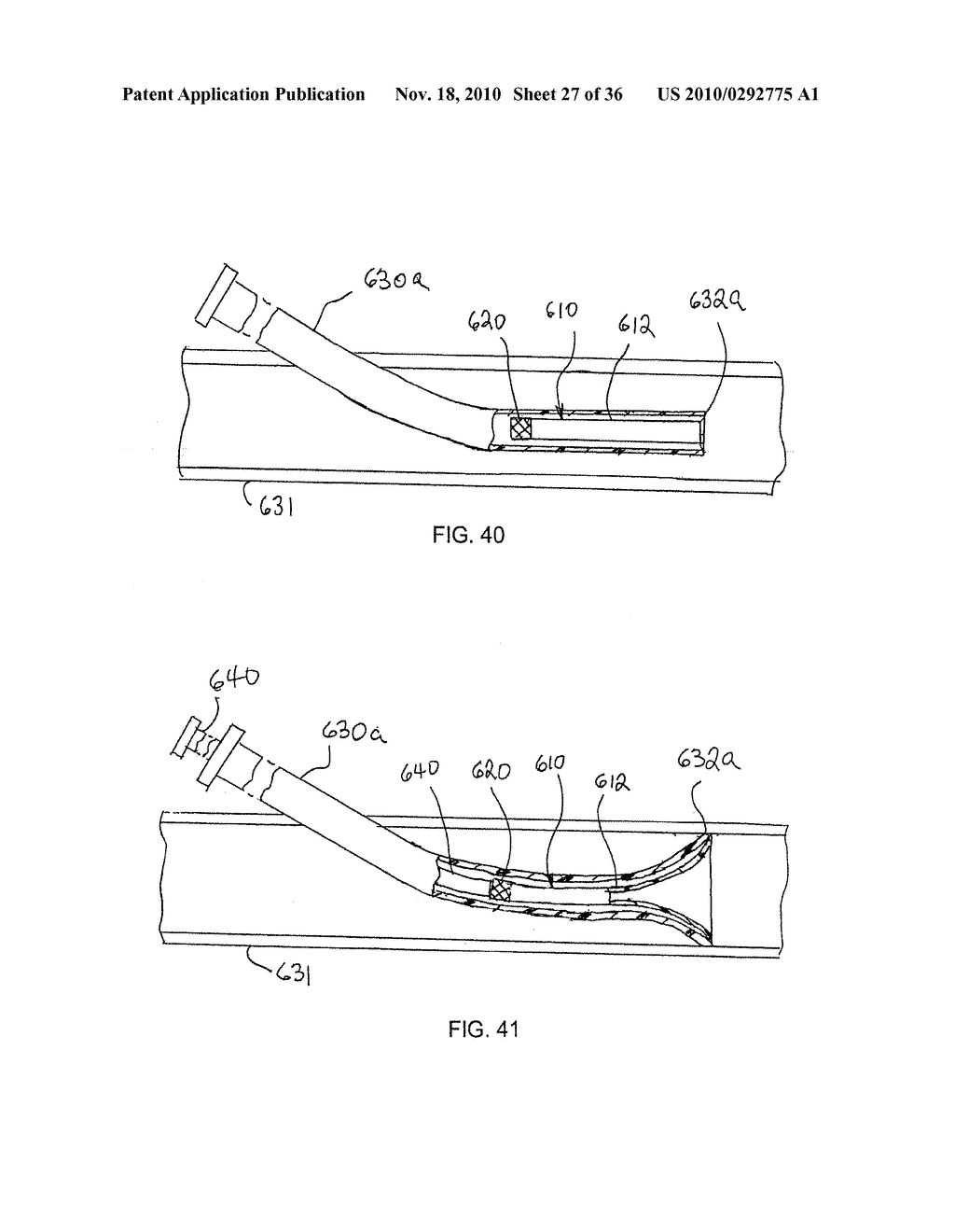 STENT/GRAFT ASSEMBLY - diagram, schematic, and image 28