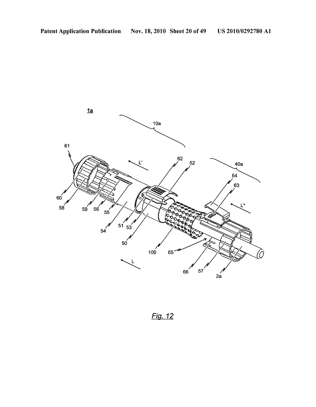 DEVICE FOR COMPRESSING A STENT AS WELL AS SYSTEM AND METHOD FOR LOADING A STENT INTO A MEDICAL DELIVERY SYSTEM - diagram, schematic, and image 21