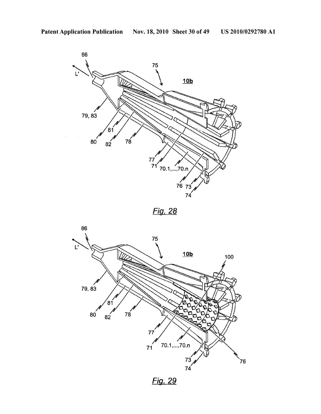 DEVICE FOR COMPRESSING A STENT AS WELL AS SYSTEM AND METHOD FOR LOADING A STENT INTO A MEDICAL DELIVERY SYSTEM - diagram, schematic, and image 31