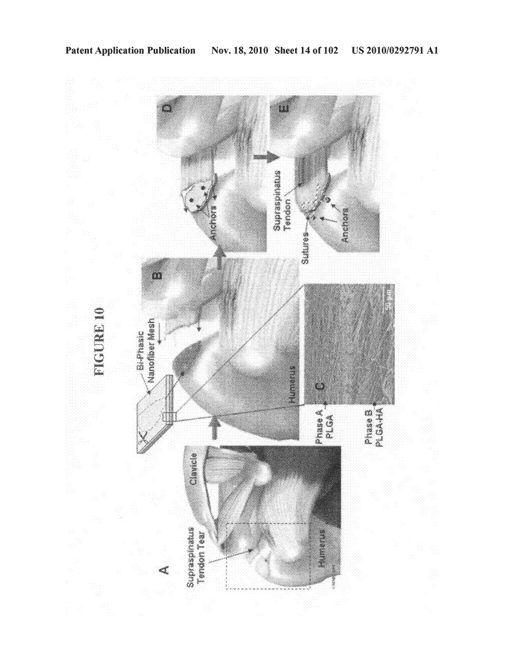 Fully synthetic implantable multi-phased scaffold - diagram, schematic, and image 15