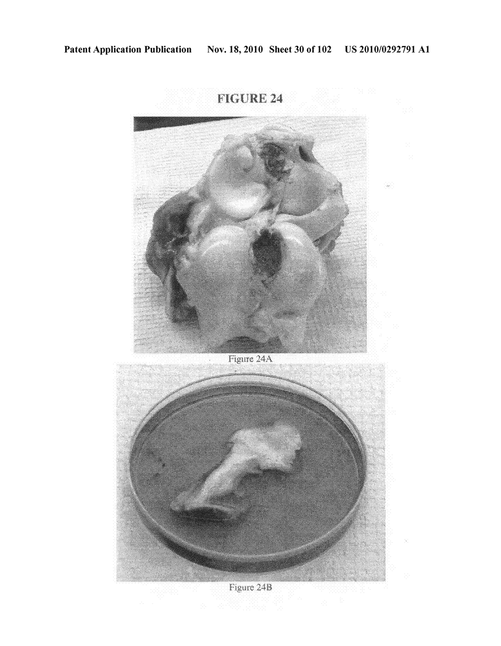 Fully synthetic implantable multi-phased scaffold - diagram, schematic, and image 31