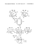 INTERVERTEBRAL DISC IMPLANTS AND TOOLING diagram and image