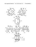 INTERVERTEBRAL DISC IMPLANTS AND TOOLING diagram and image