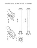 INTERVERTEBRAL DISC IMPLANTS AND TOOLING diagram and image