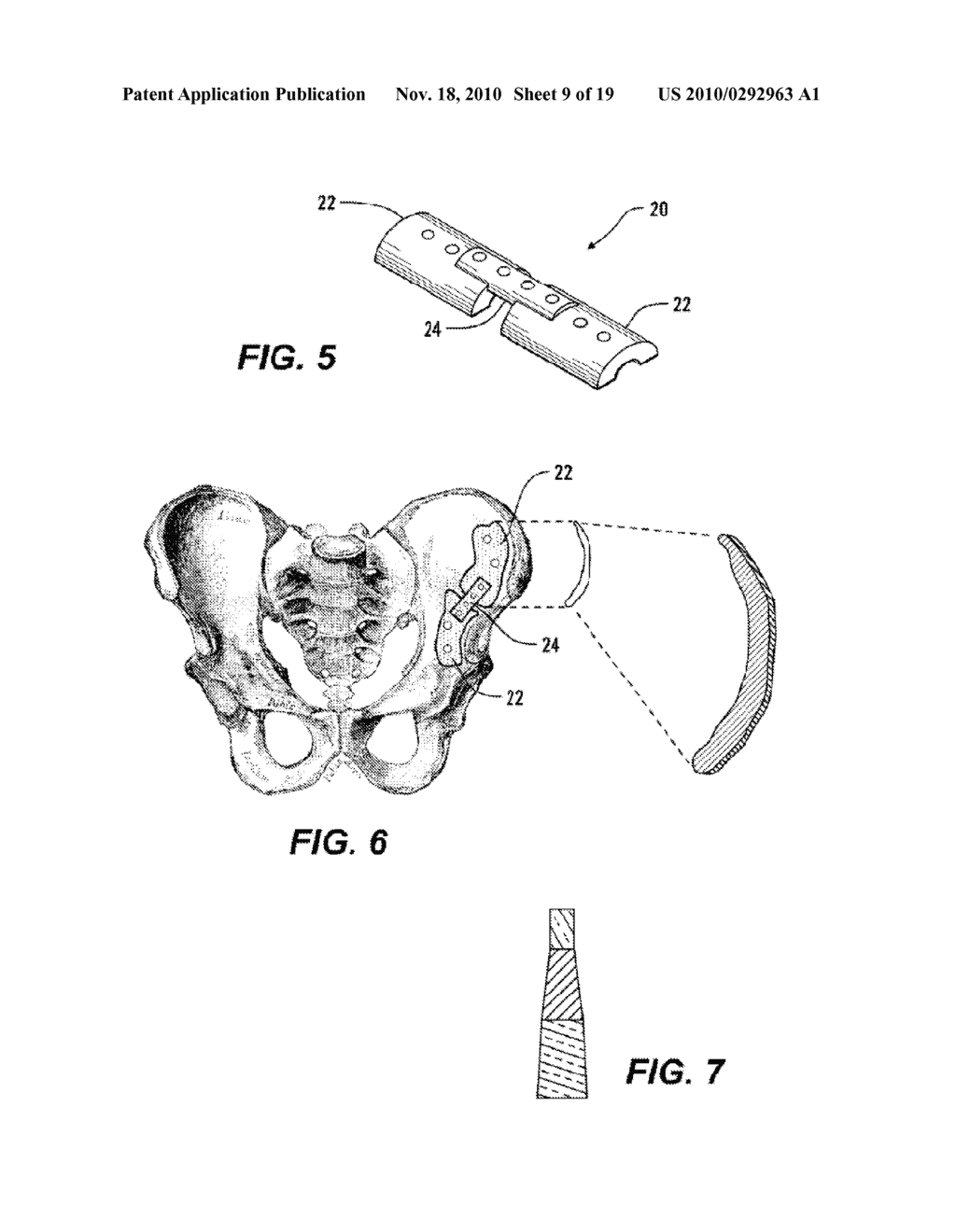 PERSONAL FIT MEDICAL IMPLANTS AND ORTHOPEDIC SURGICAL INSTRUMENTS AND METHODS FOR MAKING - diagram, schematic, and image 10