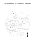 Tensioning Apparatus for Strap diagram and image