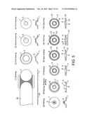 Core metal and injection gear, and process for manufacturing core metal diagram and image