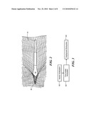 PROTECTION SYSTEM INCLUDING A NET diagram and image