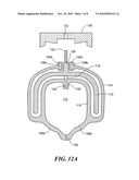 PROTECTION SYSTEM INCLUDING A NET diagram and image