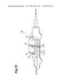 ASYMMETRIC MEMBRANE AND AIR-CONDITIONING SYSTEM USING THE SAME diagram and image