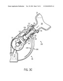 Anesthetic Vaporizer Filling System diagram and image