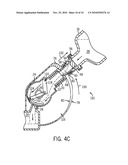 Anesthetic Vaporizer Filling System diagram and image