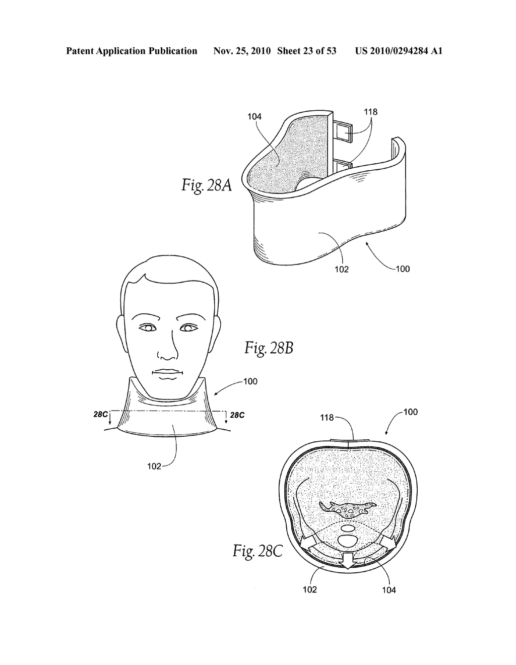 Apparatus, systems, and methods for constraining and/or supporting tissue structures along an airway - diagram, schematic, and image 24