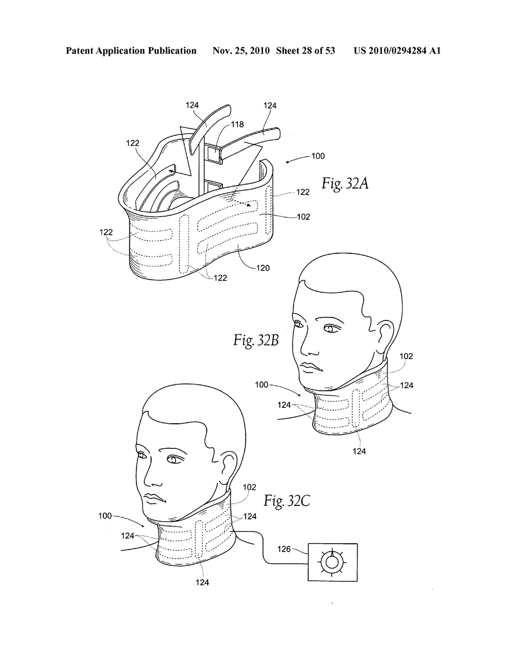 Apparatus, systems, and methods for constraining and/or supporting tissue structures along an airway - diagram, schematic, and image 29