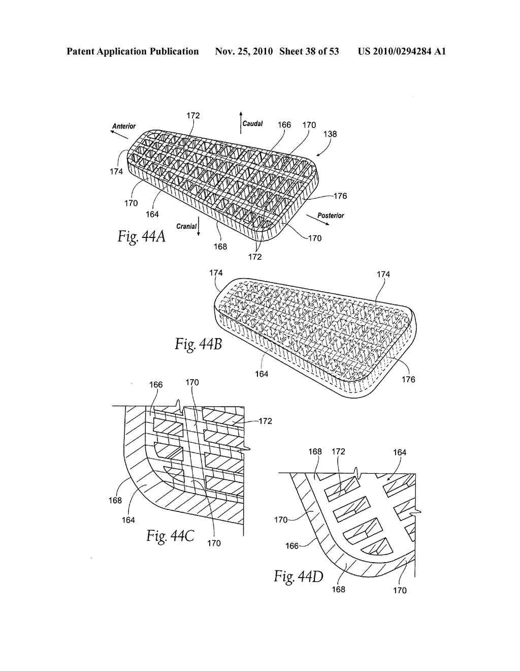 Apparatus, systems, and methods for constraining and/or supporting tissue structures along an airway - diagram, schematic, and image 39