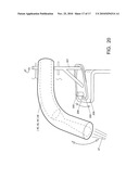 METHOD, APPARATUS AND FRAME STRUCTURE FOR CLEANING PIPE SURFACES, AND PIPE STRUCTURE TO DISTRIBUTE PARTICLES diagram and image