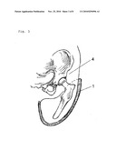 MATERIAL FOR THE FORMATION OF STRUCTURES HAVING A SUPPORT FUNCTION diagram and image