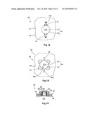 CLOTH COMPRISING SEPARABLE SENSITIVE AREAS diagram and image