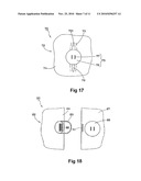 CLOTH COMPRISING SEPARABLE SENSITIVE AREAS diagram and image