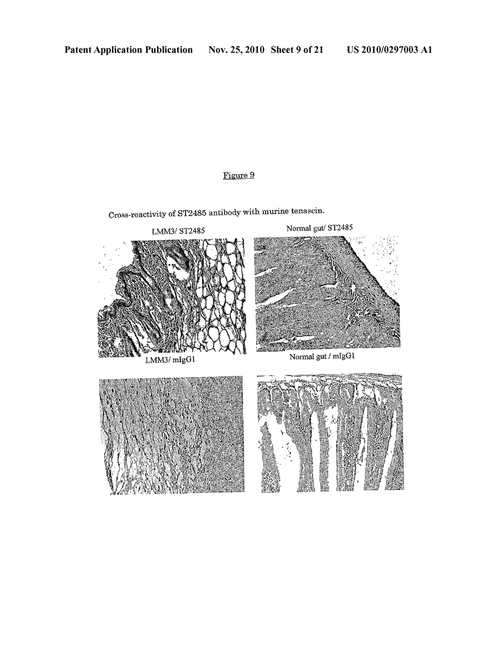 Anti-human tenascin monoclonal antibody - diagram, schematic, and image 10