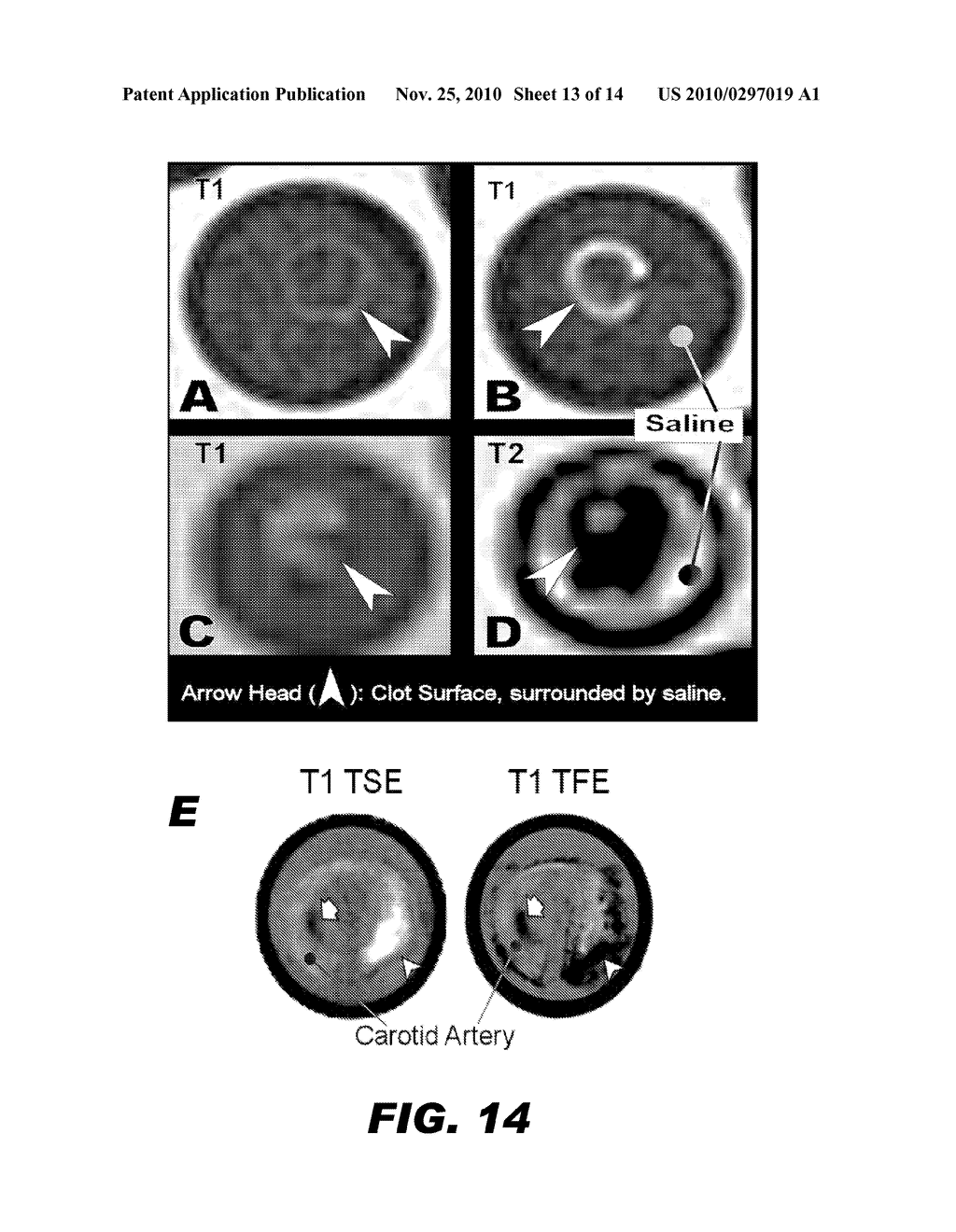 PARTICLES FOR IMAGING - diagram, schematic, and image 14