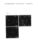 SEROTONIN 5-HT3A RECEPTORS IN TREATMENT OF NEUROLOGICAL AND PSYCHIATRIC DISORDERS diagram and image