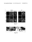 METHODS AND COMPOSITIONS FOR THE TREATMENT OF PROTEINURIC DISEASES diagram and image