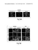 METHODS AND COMPOSITIONS FOR THE TREATMENT OF PROTEINURIC DISEASES diagram and image