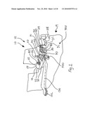 CT-based, Side-loading Surgical and Laboratory Dental Implant Guide System and Methodology of Use diagram and image