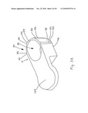 CT-based, Side-loading Surgical and Laboratory Dental Implant Guide System and Methodology of Use diagram and image