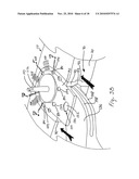 CT-based, Side-loading Surgical and Laboratory Dental Implant Guide System and Methodology of Use diagram and image