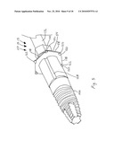 CT-based, Side-loading Surgical and Laboratory Dental Implant Guide System and Methodology of Use diagram and image