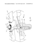 CT-based, Side-loading Surgical and Laboratory Dental Implant Guide System and Methodology of Use diagram and image