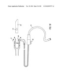 Strainer/filter unit for an aspirating filtration system and method thereof diagram and image