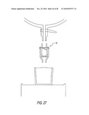 Strainer/filter unit for an aspirating filtration system and method thereof diagram and image