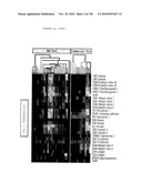 EXPRESSION PROFILE OF PROSTATE CANCER diagram and image