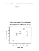 EXPRESSION PROFILE OF PROSTATE CANCER diagram and image