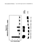 EXPRESSION PROFILE OF PROSTATE CANCER diagram and image