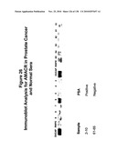 EXPRESSION PROFILE OF PROSTATE CANCER diagram and image