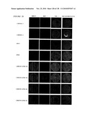 EXPRESSION PROFILE OF PROSTATE CANCER diagram and image