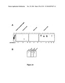 EXPRESSION PROFILE OF PROSTATE CANCER diagram and image